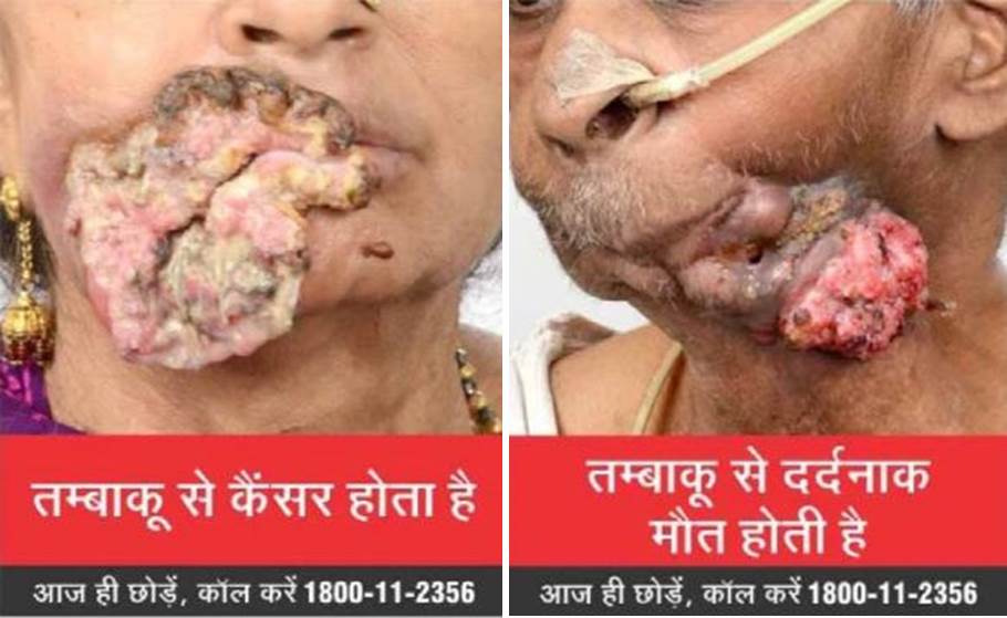 India_Pictorial warnings and quitline