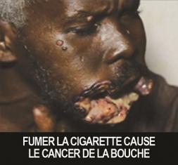 Burkina Faso: pictorial warnings required on tobacco packs
