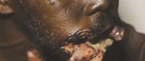 Burkina Faso: pictorial warnings required on tobacco packs